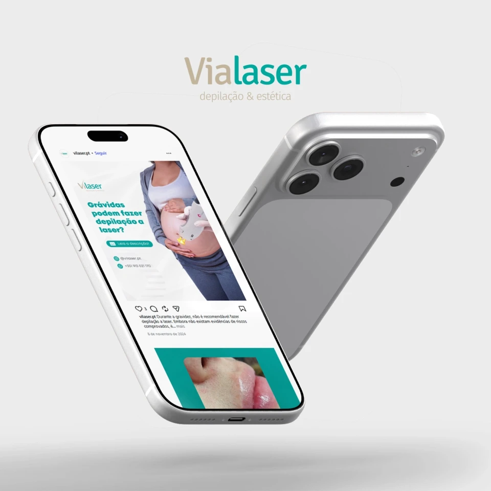 Vilaser